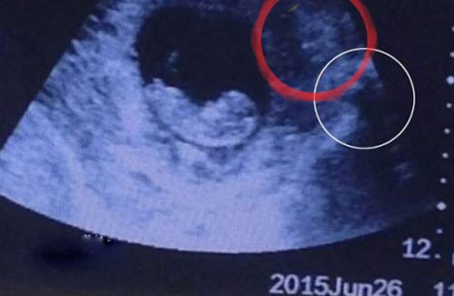 وجود شیطان در شکم یک زن باردار!+عکس