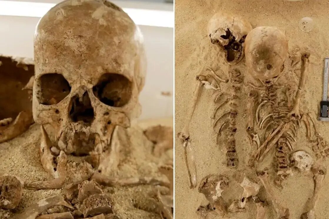 کشف یک بیماری ژنتیکی نادر در اسکلت ۱۲ هزار ساله؛ شواهدی از زندگی انسانهای اولیه کشف یک بیماری ژنتیکی نادر در اسکلت ۱۲ هزار ساله؛ شواهدی از زندگی انسانهای اولیه