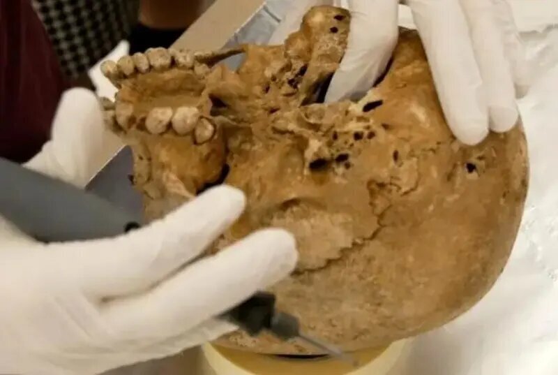 کشف یک بیماری ژنتیکی نادر در اسکلت ۱۲ هزار ساله؛ شواهدی از زندگی انسانهای اولیه کشف یک بیماری ژنتیکی نادر در اسکلت ۱۲ هزار ساله؛ شواهدی از زندگی انسانهای اولیه