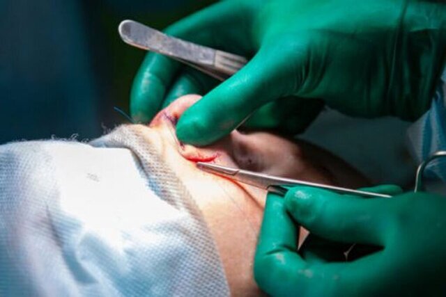 مداخله دولت پکن؛ آیا سختگیریهای جدید جلوی بحران «بینی سیاه» در صنعت زیبایی چین را میگیرد؟ مداخله دولت پکن؛ آیا سختگیریهای جدید جلوی بحران «بینی سیاه» در صنعت زیبایی چین را میگیرد؟