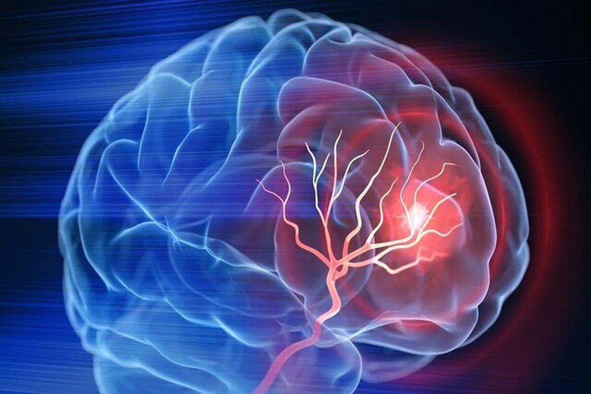 مراقب باشید؛ آلزایمر همیشه ارثی نیست! مراقب باشید؛ آلزایمر همیشه ارثی نیست!