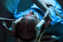 جایگزینی رادیولوژیست‌ها با هوش مصنوعی؛ خطر مرگ وجود دارد!