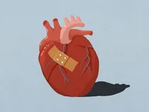 یک معیار جدید برای تشخیص سندرم قلب شکسته ارائه شد