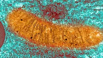 ساختار غیرطبیعی مغزهای مبتلا به آلزایمر!
